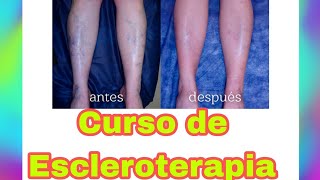 CURSO FLEBOTERAPIA MODULO 1 CURSO ESCLEROTERAPIA [upl. by Aronael970]