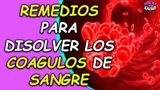 6 tratamientos naturales que te ayudan a disolver los coágulos de sangre [upl. by Kassity]