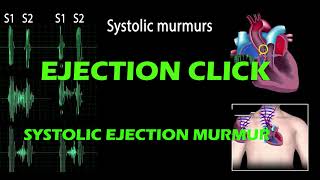 Ejection Click And Systolic Ejection Murmur pf Heart Sound [upl. by Rebel]