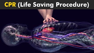 How CPR Procedure Is Performed I CPR Cardiopulmonary Resuscitation [upl. by Aisatsana204]