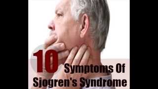 10 Major Symptoms Of Sjogrens Syndrome [upl. by Raveaux562]