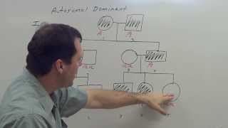 Autosomal Dominant Pedigree [upl. by Irod]