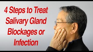 4 Steps to Treat Salivary Gland Swelling at Home [upl. by Helaine177]