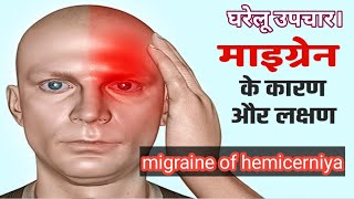 migraine of hemicerniya तनाव और सिर के चारों तरफ दर्द होना।GyanEducation11 [upl. by Gladdy]