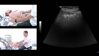 How to perform an ultrasound exam of the gastrointestinal GI tract [upl. by Lydell229]