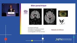 Comment la maladie de Wilson interrogetelle les neurosciences et l’interaction organescerveau [upl. by Lahey]