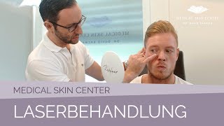 Laserbehandlung im Medical Skin Center – Dr Bacman [upl. by Nissa]