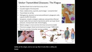 Brucellosis Plague and Lyme Disease [upl. by Bouton]