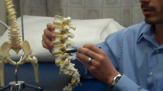 Lumbar Facet Syndrome  Back Pain  Dr Jeff Kleiner  Orthopaedics  South East Wisconsin [upl. by Adnawyt]