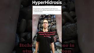 How To Stop Sweaty Feet amp Palms Hyperhidrosis Treatment [upl. by Irot]