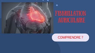 Comprendre la Fibrillation Auriculaire Explications et Exemples [upl. by Osnola995]