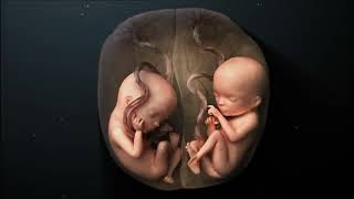 Twins pregnancy week by week जुड़वा बच्चे क्यों होते हैं [upl. by Civ720]