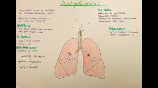 Histoplasmosis  pathophysiology histology clinics [upl. by Ransell]