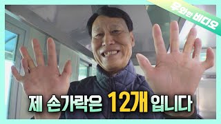 손가락 발가락 다 합치면 24개 희귀 다지증의 스마일 맨의 꿈┃Fingers  Toes  24 The Dream of a Man with Polydactylism [upl. by Dhiman995]