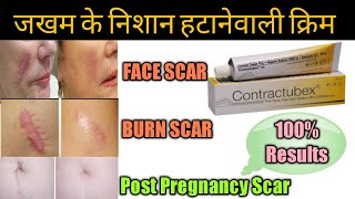 Contractubex Gel review पुराने से पुराने scars Marks को जड़ से मिटा देता है ये जेल।। [upl. by Ridinger153]