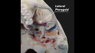 Temporomandibular joint TMJ and its articular disc [upl. by Broome628]