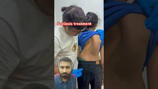 Scoliosis treatment kar diya  drrajneeshkant  shortsfeed shortfeed shortsfeed trending [upl. by Neelrad114]