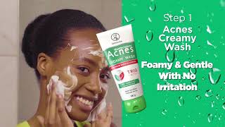 ACNES KENYA  Quickly Clears Pimples [upl. by Diehl]