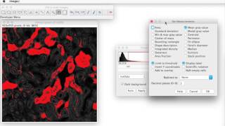 FIJI for Quantification Area of Stain [upl. by Kciredor]