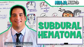 Subdural Hematoma  Anatomy Etiology Pathophysiology Clinical Features Treatment [upl. by Jana]