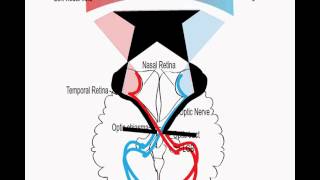 Visual pathway and visual field defects [upl. by Acinoryt]