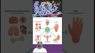 Candida Fungal Infection  Candidiasis  Urdu  Hindi  Shahbaz Qamar [upl. by Wentworth]