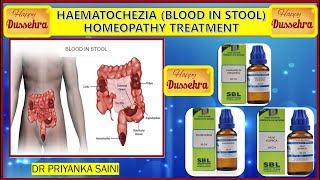 HAEMATOCHEZIA BLOOD IN STOOL  HOMEOPATHY TREATMENT  PILES  FISSURE drpriyankashomeopathy [upl. by Nairahcaz]