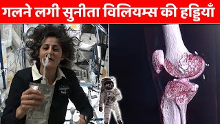 गलने लगी सुनीता विलियम्स की हड्डियाँ  Astronaut Sunita Williamss Bones are Getting Weak [upl. by Helga]