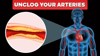 Clogged Arteries Shocking Symptoms amp Natural Solutions FAST [upl. by Winser]