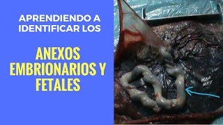 Aprendiendo a identificar los Anexos Embrionarios y Fetales [upl. by Aniri730]