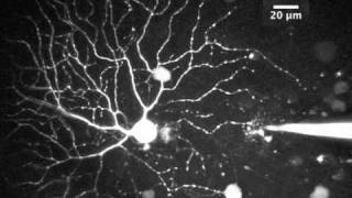 Two photon imaging in the PV retina [upl. by Delorenzo385]