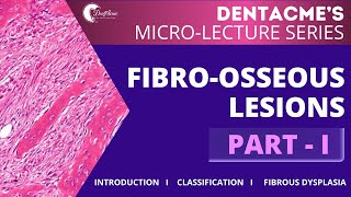 FIBROOSSEOUS LESIONS PARTI by DentAcme neetmdslectures neetmds inicetmds inbde afk adc [upl. by Ayeka]