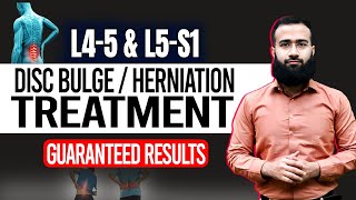 Get Rid Of L4 L5 And L5 S1 Disc Bulge With This Home Treatment  Guaranteed Results [upl. by Pierpont]