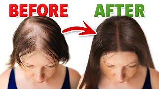 Try 10 Min Ultimate Super Thick Hair  Hair Growth Subliminal Frequency  Hair Loss Treatment Music [upl. by Recnal]