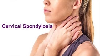 CERVICAL SPONDYLOSIS [upl. by Nadruoj]