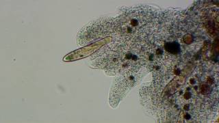 Amoeba stalks and captures paramecia to original music [upl. by Lateh132]