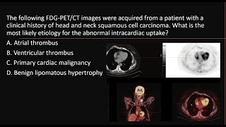 Cardiovascular uptake using PET in oncological patients MCQs nuclearmedicineMCQ petct frcr [upl. by Shlomo]