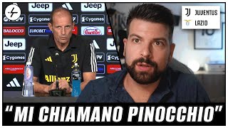 ALLEGRI POMPIERE spegne le fiamme su Bonucci e Pogba  Conferenza Stampa Pre Juventus Lazio [upl. by Ghassan]