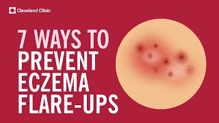 7 Ways to Prevent Eczema FlareUps [upl. by Lehar903]