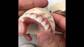 Locator Denture [upl. by Farnsworth152]