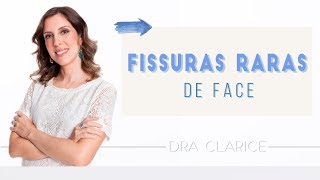 Dra Clarice Abreu  Fissuras raras de face [upl. by Hildegarde717]