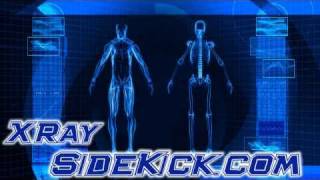 Orbits Mandible TMJ Sinuses X Ray Radiography Positioning How To Guide [upl. by Bysshe737]