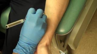 Allergy Testing Step 1 Skin Prick Testing [upl. by Areyk]