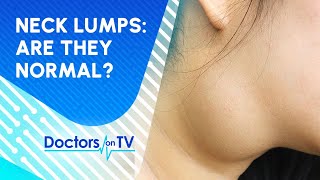 Is a Lump on Neck a Sign of Major Health Concern [upl. by Vadim189]