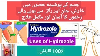 Hydrozole cream uses in Urdu [upl. by Cath868]