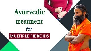 Ayurvedic Treatment for Multiple Fibroids  Swami Ramdev [upl. by Jillayne]