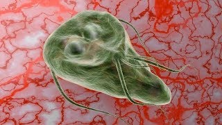 Giardia lamblia  zakażenie objawy leczenie [upl. by Kevyn36]