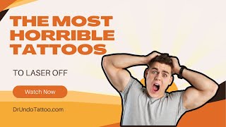 Laser Tattoo Removal Not For These Horrible tattoos Impossible [upl. by Kathi]