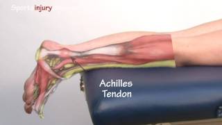 Achilles Tendonitis  Tendinopathy  Explained in 90 Seconds [upl. by Holton]