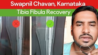 1 महीने में walker छूट गया  Tibia Fibula Fracture  Swapnil Chavan  Karnataka  tutihaddikailaj [upl. by Harpole]